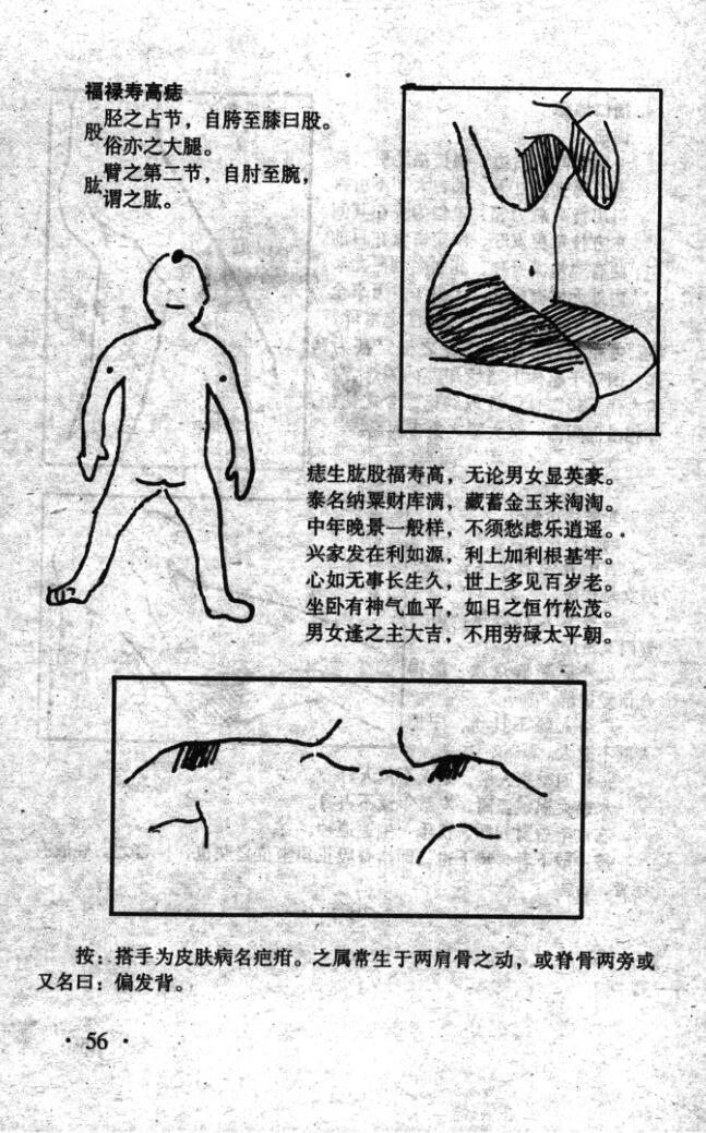 《痣斑命相大全》插图4